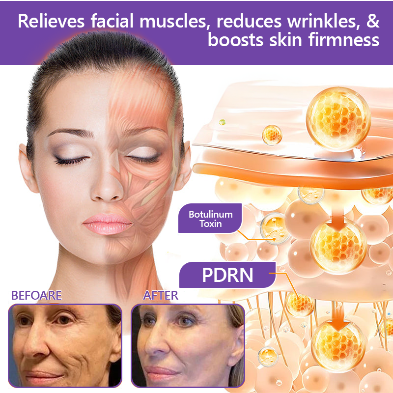 Aeramisgoods®🔥PDRN Multi-Peptide Massaging Body Roller Cream- Anti-aging, Hydrating, Skin Firming & Lifting, Skin Repair, Even Tone, Acne and Dark Spot Treatment, Wart and Mole Removal, and Psoriasis Relief