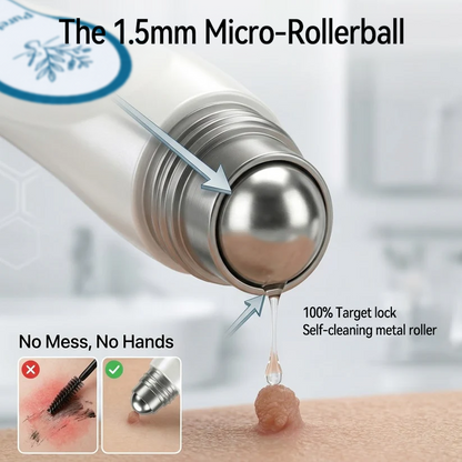 Quillanco® Skin Tag Remover Roller🌟🏆