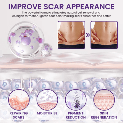 Luxevéria® ReGenScar Stem Cell Scar Gel