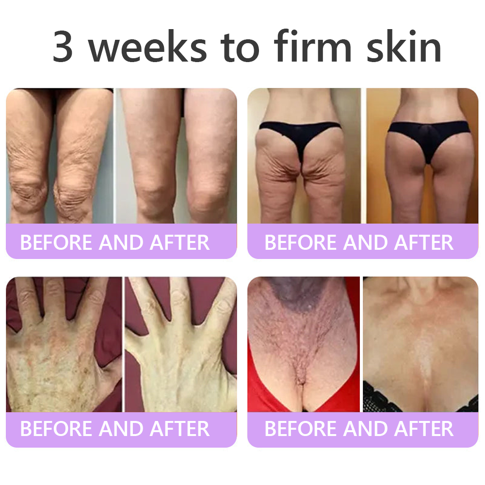 Aeramisgoods®🔥PDRN Multi-Peptide Massaging Body Roller Cream- Anti-aging, Hydrating, Skin Firming & Lifting, Skin Repair, Even Tone, Acne and Dark Spot Treatment, Wart and Mole Removal, and Psoriasis Relief