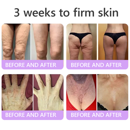 Aeramisgoods®🔥PDRN Multi-Peptide Massaging Body Roller Cream- Anti-aging, Hydrating, Skin Firming & Lifting, Skin Repair, Even Tone, Acne and Dark Spot Treatment, Wart and Mole Removal, and Psoriasis Relief