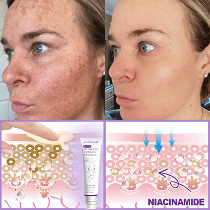 Aeramisgoods®🔥PDRN Multi-Peptide Massaging Body Roller Cream- Anti-aging, Hydrating, Skin Firming & Lifting, Skin Repair, Even Tone, Acne and Dark Spot Treatment, Wart and Mole Removal, and Psoriasis Relief