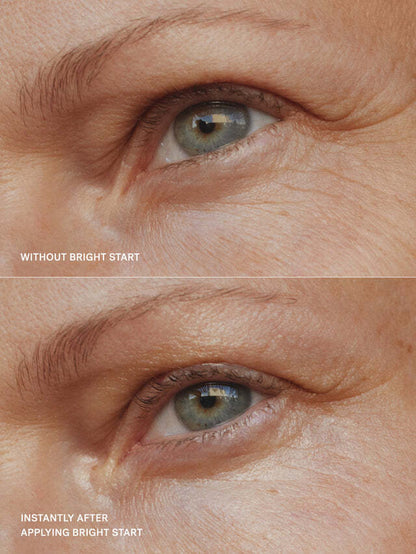 Quillanco-Bright Start Retinol Alternative Eye Cream